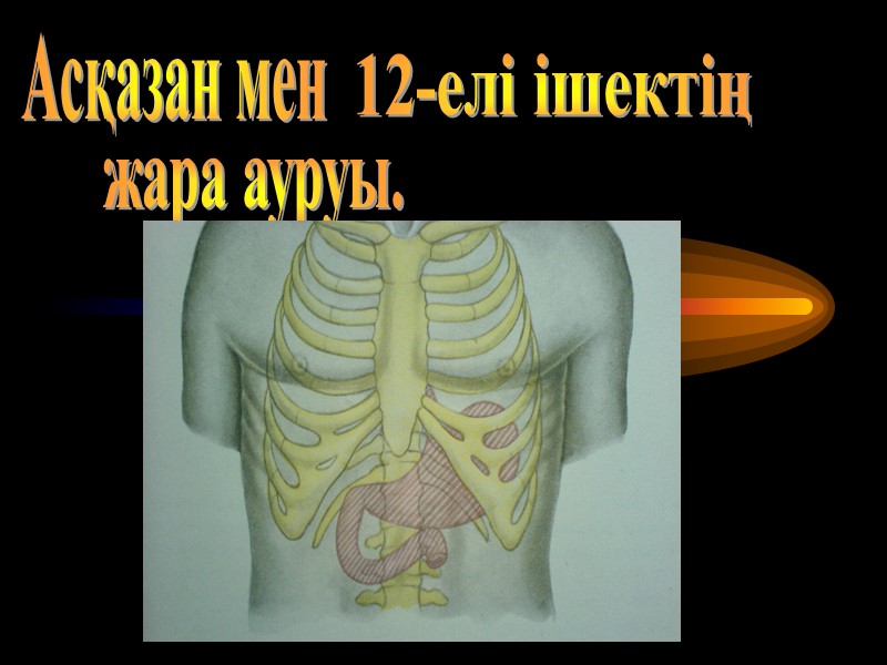 Асқазан мен  12-елі ішектің  жара ауруы.